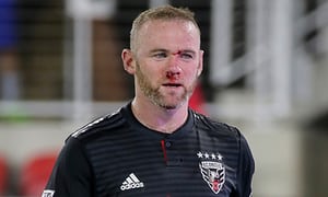 0_1532894483648_wayne rooney bloody nose.jpg