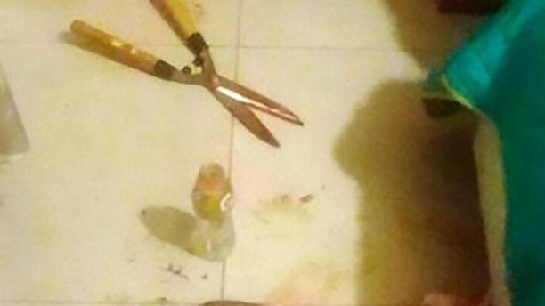 0_1525105130522_Woman cut off boyfriend’s manhood for leaking their sex tape.jpg